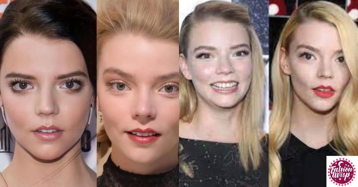 Anya Taylor Joy Before and After Enhancements Fillers, Uplifts, or Fat Removal Surgery (1)