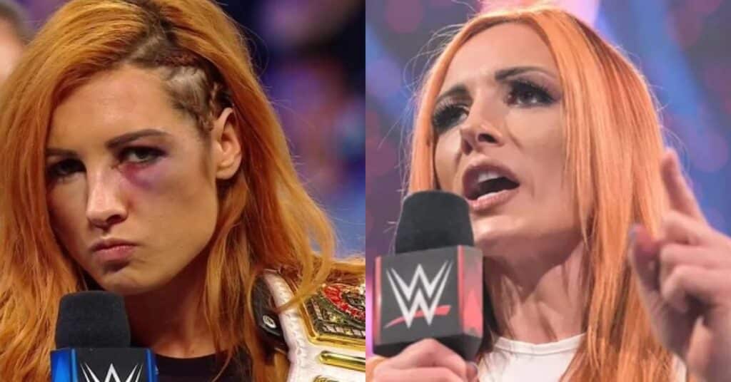 Becky Lynch Plastic Surgery: The Truth Behind Her ESPY Appearance