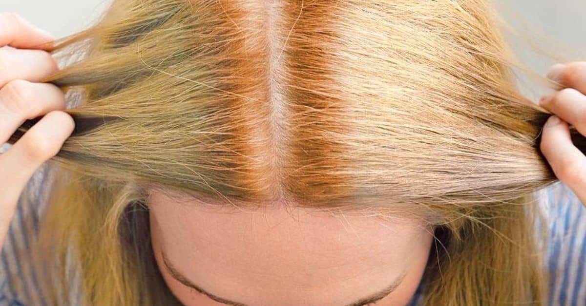 HOW TO FIX ORANGE HAIR AFTER BLEACHING: 5 AT-HOME TIPS