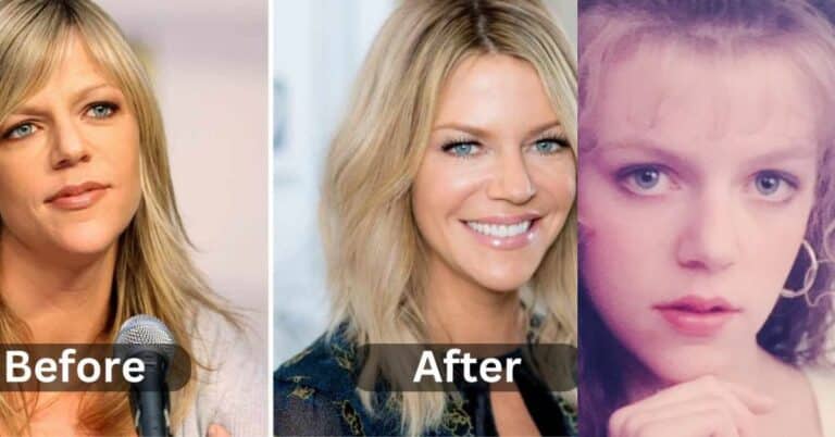 Kaitlin Olson Plastic Surgery: From Sunny Sets to Speculative Surgeries