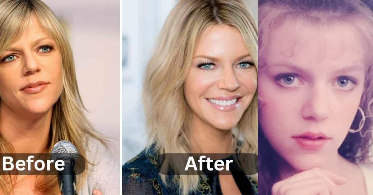 KAITLIN OLSON PLASTIC SURGERY: FROM SUNNY SETS TO SPECULATIVE SURGERIES