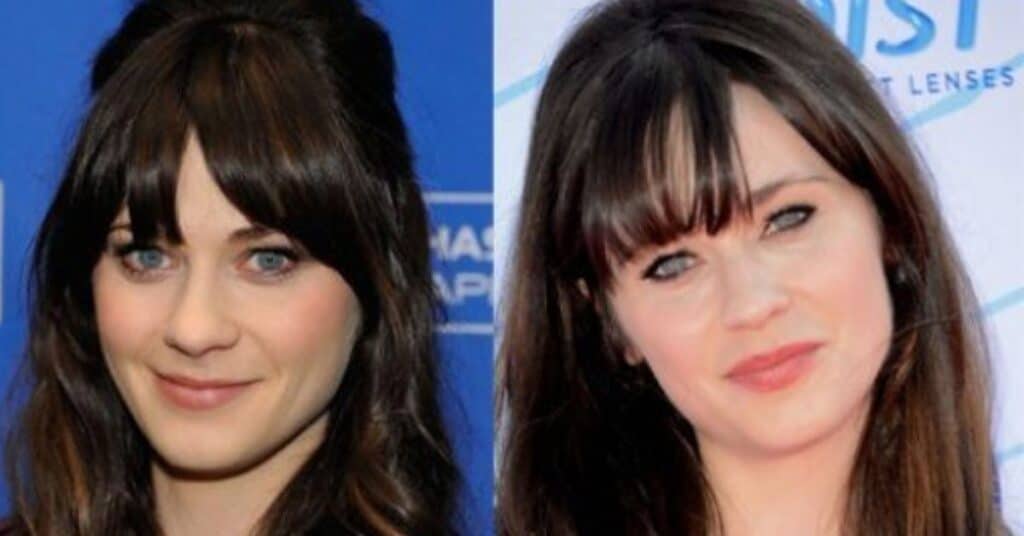 What Plastic Surgery Is Zooey Deschanel Rumored to Have Had?