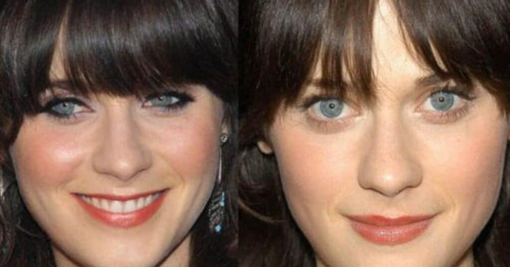 Zooey Deschanel Plastic Surgery: Nose Job, Lip Fillers and What Not?