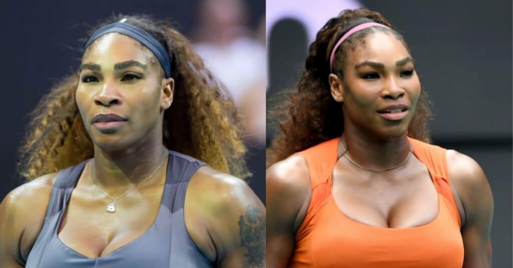 Serena Williams Plastic Surgery in 2010