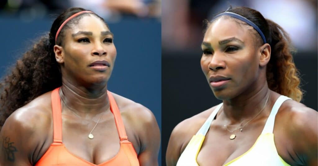Serena Williams Plastic Surgery: Nose Job, Breast Implants, or Skin Whitening Treatment?