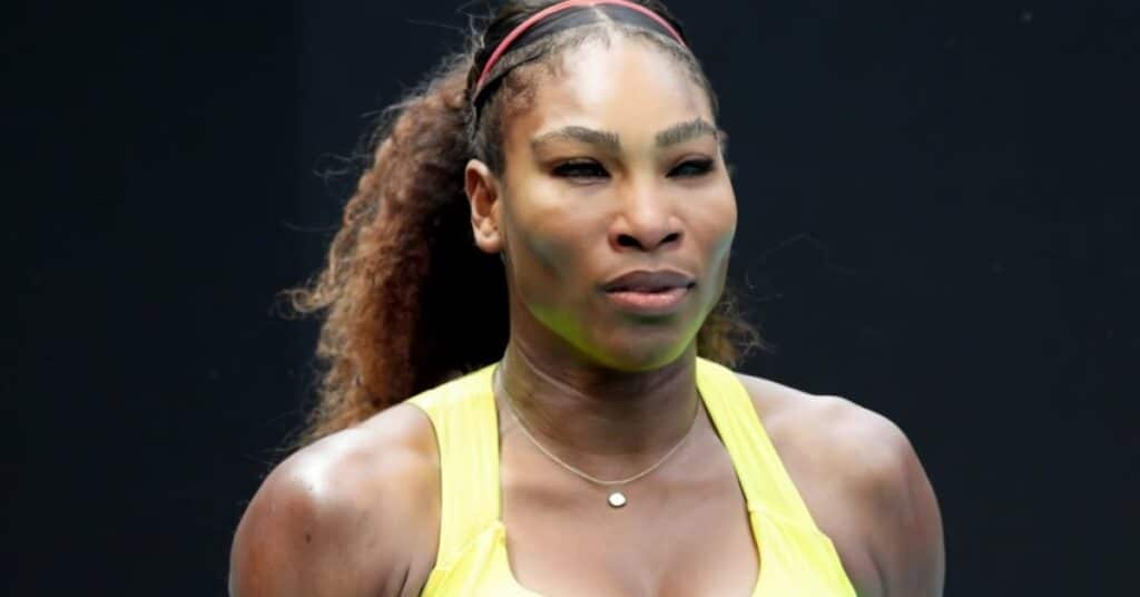 Serena Williams Plastic Surgery in 2023